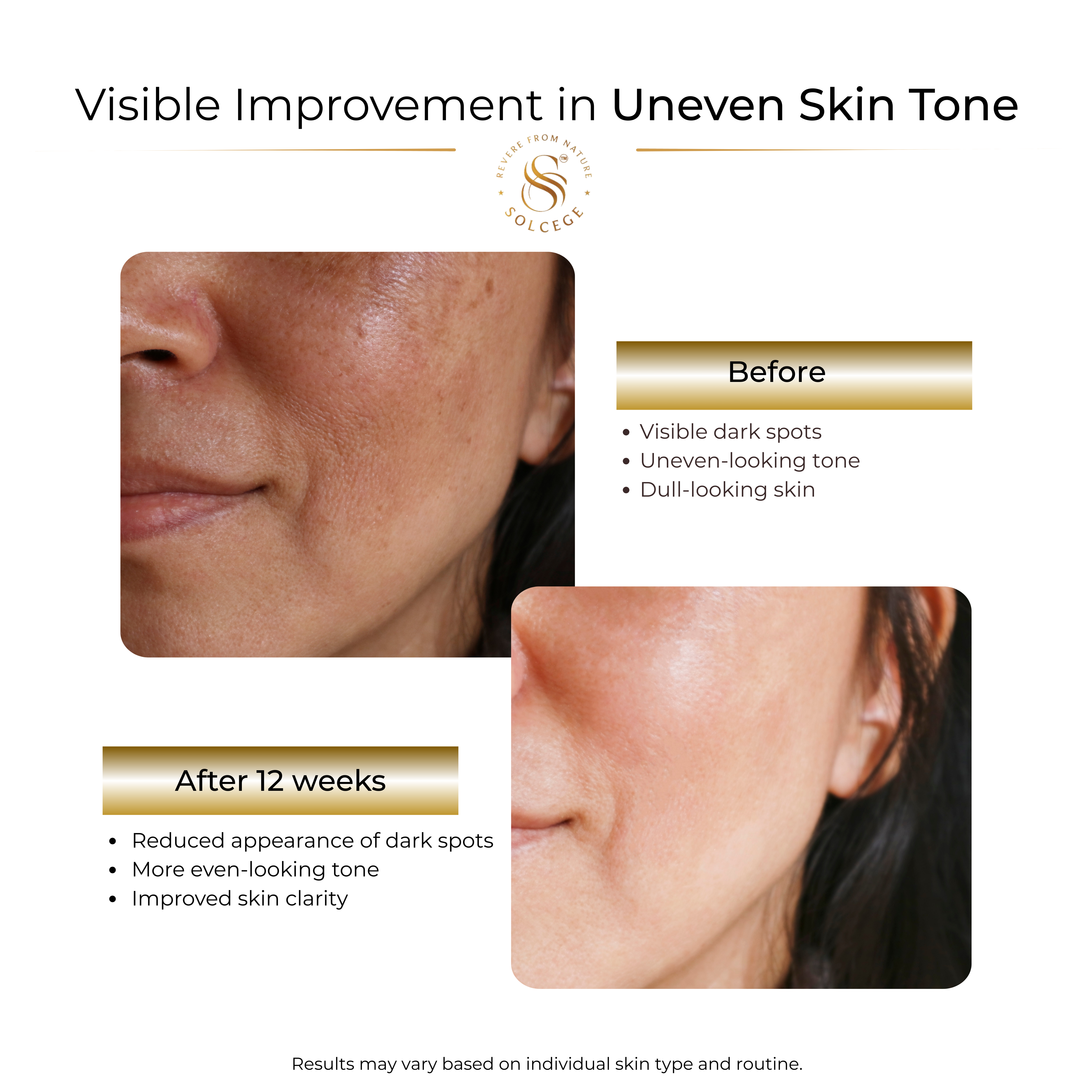 Vitamin C - Anti-aging and Skin Brightening Serum, 1oz